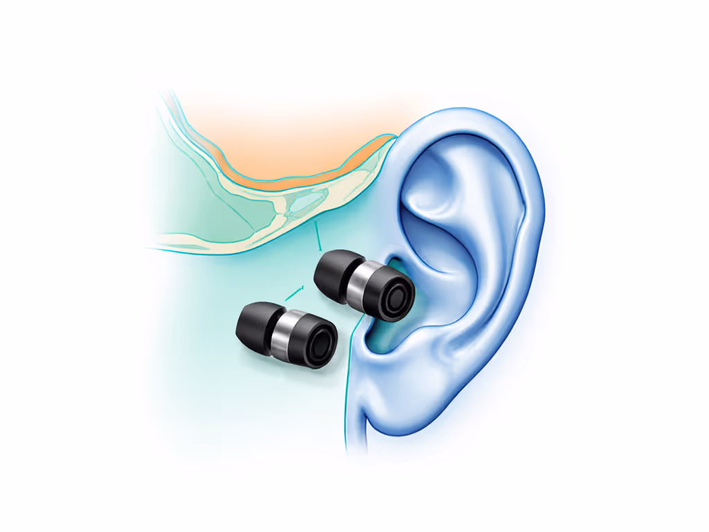ear_canal_anatomy_showing_seal_pressure_zones
